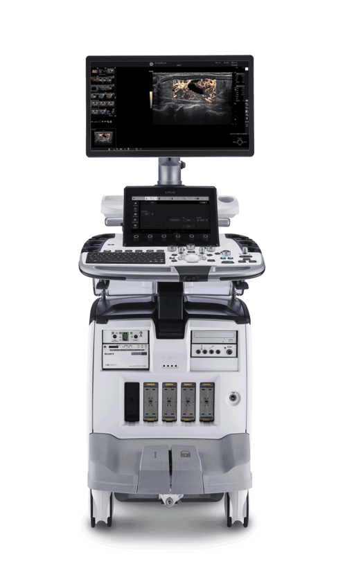 Ultrasound