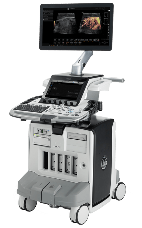 Ultrasound1