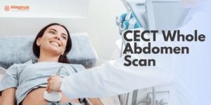 CECT Whole Abdomen Scan