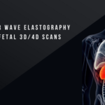 Liver Shear Wave 3D/4D Scans